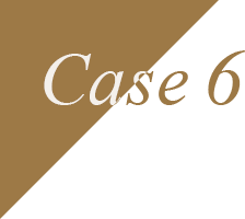Case6